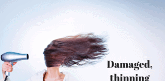 dry brittle thinning hair loss 