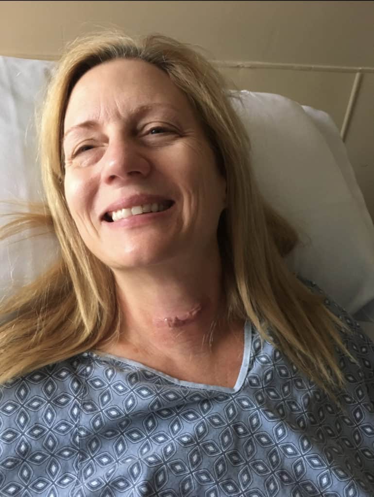 Thyroid_scar_after_surgery_removed