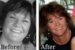 before and after health coaching